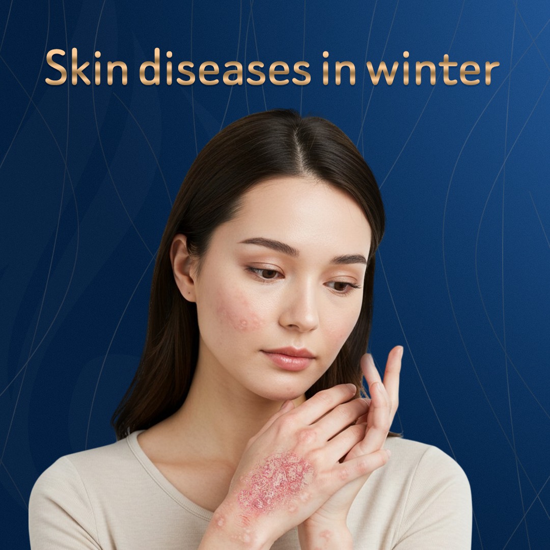 أمراض جلدية شائعة في فصل الشتاء